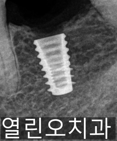 이미지1